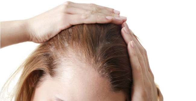 Understanding Hair Loss, Thinning, and FUE Hair Transplant Costs in Sydney